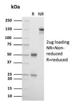 SDS-PAGE Analysis of purified Intestinal FABP/Intestinal fatty acid-binding protein antibody (FABP2/6345). Confirmation of Purity and Integrity of Antibody.