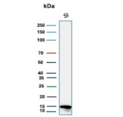 Intestinal FABP Antibody Human Intestine WB. Western blot analysis of human small intestine tissue lysate using Intestinal FABP/Intestinal fatty acid-binding protein antibody (FABP2/6345).