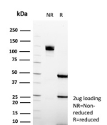 SDS-PAGE Analysis purified Intestinal fatty acid-binding protein/I-FABP antibody (clone FABP2/6936). Confirmation of Integrity and Purity of Antibody.