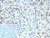 FCGR1A Antibody Human Tonsil Tissue IHC. Immunohistochemistry analysis of FCGR1A (CD64). Formalin-fixed, paraffin-embedded human tonsil tissue stained with FCGR1A/High affinity immunoglobulin gamma Fc receptor I antibody (clone FCGR1A/7499). Brown chromogenic signal indicates FCGR1A-positive cells, with membranous and cytoplasmic brown staining observed in immune cells within the tonsillar tissue. Inset shows PBS used in place of primary antibody as a secondary-only negative control. Heat-induced epitope retrieval was performed by heating tissue sections in 10mM Tris with 1mM EDTA, pH 9.0, for 45 minutes at 95oC, followed by cooling at room temperature for 20 minutes.