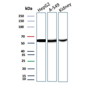 Western blot analysis of human HepG2 and A549 cell lysates and human kidney tissue lysate using recombinant D-dimer antibody (FGG/13043R). An immunoreactive band is observed at approximately 50â55 kDa, consistent with the predicted molecular weight of the fibrinogen gamma chain from which D-dimer neoepitopes are derived.