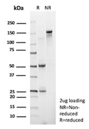 SDS-PAGE Analysis of purified recombinant D-dimer antibody (clone FGG/13043R). Confirmation of Purity and Integrity of Antibody.