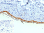 FLG Antibody Human Skin Tissue IHC. Formalin-fixed, paraffin-embedded human skin stained with recombinant FLG/Filaggrin antibody (clone r15C10). Brown chromogenic signal is localized to the superficial epidermal layers, consistent with Filaggrin-positive keratinocytes in the stratum granulosum and stratum corneum. Inset shows PBS substituted for the primary antibody as a secondary-only negative control. Staining of formalin-fixed tissues requires heating tissue sections in 10mM Tris with 1mM EDTA, pH 9.0, for 45 min at 95oC followed by cooling at RT for 20 minutes.