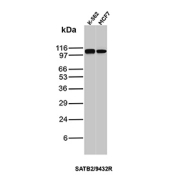SATB2 Transcription Factor Antibody WB. Western blot analysis of human K562 and MCF7 cell lysates using recombinant SATB2 Transcription Factor antibody (clone SATB2/9432R). A single band is detected at approximately 100 kDa, which is slightly higher than the predicted molecular weight of SATB2 (~83 kDa), consistent with post-translational modification and known aberrant migration of chromatin-associated transcription factors.