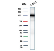 SATB2 Transcription Factor Antibody K562 Cell WB. Western blot analysis of human K562 cell lysates using recombinant SATB2 Transcription Factor antibody (clone SATB2/9432R). A single band is detected at approximately 100 kDa, which is slightly higher than the predicted molecular weight of SATB2 (~83 kDa), consistent with post-translational modification and known aberrant migration of chromatin-associated transcription factors.