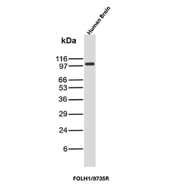 FOLH1 Antibody WB. Western blot analysis of human brain tissue lysate using recombinant FOLH1/Prostate-specific membrane antigen antibody (clone FOLH1/9735R). Predicted molecular weight ~100 kDa.