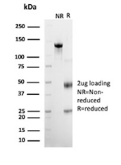 SDS-PAGE Analysis of purified GPC3/Glypican-3 antibody (clone GPC3/12698). Confirmation of Purity and Integrity of Antibody. Confirmation of Purity and Integrity of Antibody.