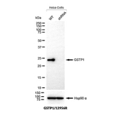 Western blot analysis of human, mouse, rat, hamster, guinea pig, and rabbit brain, heart, and lung tissue lysates probed with recombinant GSTP1/Glutathione S-transferase pi 1 antibody (clone GSTP1/12956R). A single prominent band is detected near the predicted molecular weight of approximately 23 kDa, consistent with Glutathione S-transferase pi 1. The conserved band pattern across multiple tissues and species supports specific detection of GSTP1, a cytosolic phase II detoxification enzyme broadly expressed in epithelial and parenchymal cells.