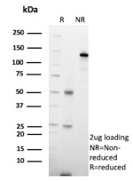SDS-PAGE Analysis of purified Non-classical MHC class I antibody (clone HLAE/13126). Confirmation of Purity and Integrity of Antibody.