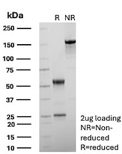 SDS-PAGE Analysis of purified recombinant APC/Adenomatous polyposis coli antibody (clone rEMM43). Confirmation of Purity and Integrity of Antibody.