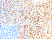 Immunohistochemistry analysis of CD25 / IL2RA antibody (clone rIL2RA/12624) in human tonsil. Formalin-fixed, paraffin-embedded human tonsil tissue shows membranous and cytoplasmic brown chromogenic staining in scattered lymphoid cells, consistent with IL2RA-positive immune cell populations. Inset shows a PBS-only negative control processed without primary antibody, demonstrating minimal non-specific background staining.