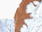 Immunohistochemistry analysis of Suprabasal keratin / Cytokeratin 10 antibody (clone KRT10/9605R) in human skin. Formalin-fixed, paraffin-embedded human skin tissue shows strong cytoplasmic brown chromogenic staining in suprabasal keratinocytes within stratified squamous epithelium, consistent with Cytokeratin 10 expression in differentiated epidermal layers. Heat-induced epitope retrieval was performed using 10mM Tris with 1mM EDTA, pH 9.0, for 45 minutes at 95oC followed by cooling at room temperature for 20 minutes. Inset shows a PBS-only negative control processed without primary antibody, demonstrating minimal non-specific background staining.