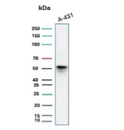 Western blot analysis of human A431 cell lysate using Suprabasal Keratin/Cytokeratin 10 antibody (clone KRT10/9605R). Predicted molecular weight ~59 kDa.