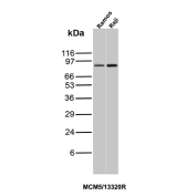 MCM5 Antibody Cell Line Western Blot. Western blot analysis of MCM5 expression in human cell lysates using MCM5 antibody clone MCM5/13320R. A distinct band is detected at approximately 80-90 kDa, consistent with the expected molecular weight of MCM5.
