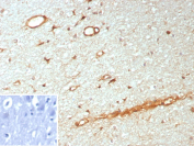 IHC staining of NTRK3/Neurotrophic receptor tyrosine kinase 3 antibody (clone NTRK3/8796). FFPE human brain tissue shows HRP-DAB brown staining in neuronal cell bodies and neuropil with membranous and cytoplasmic distribution, consistent with known expression of Neurotrophic receptor tyrosine kinase 3 in central nervous system tissue. Inset: PBS instead of primary antibody; secondary only negative control. Staining of formalin-fixed tissues requires heating tissue sections in 10mM Tris with 1mM EDTA, pH 9.0, for 45 min at 95oC followed by cooling at RT for 20 minutes.