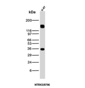 Western Blot Analysis of NTRK3 / TrkC antibody (clone NTRK3/8796). U-87 human glioblastoma cell lysate shows two major immunoreactive bands at approximately 36 kDa and 130-140 kDa. The predicted molecular weight of full-length TrkC is approximately 90-95 kDa; however, extensive glycosylation of the extracellular region can shift the apparent molecular weight to 120-140 kDa on SDS-PAGE. The lower ~36 kDa band is consistent with a truncated or processed NTRK3 isoform lacking portions of the receptor, which has been reported for kinase-deficient splice variants. The presence of both higher glycosylated and lower truncated forms reflects known isoform diversity and post-translational modification of Neurotrophic receptor tyrosine kinase 3.