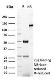 SDS-PAGE Analysis of Purified SERPINE1/Serpin family E member 1 antibody (rTJA6). Confirmation of Purity and Integrity of Antibody.