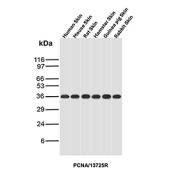 Western blot analysis of PCNA Proliferation Marker antibody in multi-species skin lysates. Western blot was performed using PCNA Proliferation Marker antibody (clone PCNA/13725R) on human skin, mouse skin, rat skin, hamster skin, guinea pig skin, and rabbit skin tissue lysates. A clear immunoreactive band is detected at approximately 29 kDa in all species tested, consistent with the predicted molecular weight of Proliferating Cell Nuclear Antigen. The conserved band size across species reflects the high sequence conservation of PCNA among mammals. The detected signal corresponds to the predicted molecular weight under reducing conditions. PCNA is a nuclear replication factor expressed in proliferating cells within skin tissue, and the consistent band pattern supports specific recognition of endogenous PCNA across multiple mammalian species.