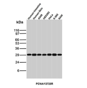 Western blot analysis of PCNA Proliferation Marker antibody in human and mouse lysates. Western blot was performed using PCNA Proliferation Marker antibody (clone PCNA/13725R) on human intestine, human skin, A549, HEK293, HeLa, K-562, and mouse Raw cell lysates. A distinct immunoreactive band is detected at approximately 29 kDa across all lanes, consistent with the predicted molecular weight of Proliferating Cell Nuclear Antigen. The uniform band intensity reflects the constitutive expression of PCNA in actively proliferating cells and tissues. The detected signal aligns with the predicted molecular weight under reducing conditions. PCNA is a nuclear replication factor expressed during S phase, and its consistent detection across multiple proliferative cell types supports specific recognition of endogenous PCNA.