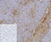 Immunohistochemistry analysis of CD243 / Multidrug Resistance 1 antibody in human adrenal gland. FFPE human adrenal gland tissue was stained with CD243 / Multidrug Resistance 1 antibody (clone ABCB1/9309). HRP-DAB brown chromogenic signal is observed predominantly along the plasma membrane of adrenal cortical cells, producing a distinct membranous staining pattern consistent with the known localization of the p170 ABCB1 drug efflux transporter. Cortical cell populations demonstrate variable membrane-associated staining intensity, while stromal elements show minimal background signal. The inset negative control using PBS instead of primary antibody shows no specific brown staining. Nuclei are counterstained blue. Heat-induced epitope retrieval was performed by boiling tissue sections in 10 mM Tris with 1 mM EDTA, pH 9.0, for 45 minutes at 95oC followed by cooling at room temperature prior to antibody incubation.