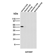 Western blot analysis of Alpha-1 Proteinase Inhibitor / AAT antibody in multiple species lung tissues. Western blot was performed using Alpha-1 Proteinase Inhibitor / AAT antibody (clone AAT/4487) on lung tissue lysates from human, mouse, rat, hamster, and guinea pig. A distinct immunoreactive band is detected at approximately 52 kDa in human lung, consistent with the predicted molecular weight of SERPINA1, also known as Alpha-1 Proteinase Inhibitor. No comparable band is observed in the tested rodent or guinea pig samples under these conditions. The detected signal corresponds to the predicted molecular weight under reducing conditions. The species-restricted reactivity pattern observed in this assay suggests preferential recognition of human AAT by clone AAT/4487.