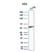 Western blot analysis of Alpha-1 Proteinase Inhibitor / AAT antibody in human lung. Western blot was performed using Alpha-1 Proteinase Inhibitor / AAT antibody (clone AAT/4487) on human lung tissue lysate. A distinct immunoreactive band is detected at approximately 52 kDa, consistent with the predicted molecular weight of SERPINA1, also known as Alpha-1 Proteinase Inhibitor. The band may appear slightly diffuse, which is consistent with the glycosylated nature of this secreted serpin. The detected signal corresponds to the predicted molecular weight under reducing conditions. Expression in lung tissue aligns with the physiologic role of Alpha-1 Proteinase Inhibitor in protecting alveolar structures from neutrophil elastase-mediated damage, supporting specific detection of endogenous AAT.
