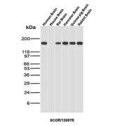 Western blot analysis of Transcriptional Corepressor BCOR antibody in brain tissue lysates from multiple species. Human brain, mouse brain, rat brain, hamster brain, guinea pig brain, and rabbit brain lysates each show a prominent band at approximately 190 kDa, consistent with the predicted molecular weight of BCOR. The banding pattern is conserved across species, supporting recognition of BCOR protein in diverse mammalian brain tissues. The observed signal corresponds to full-length BCL-6 corepressor under reducing SDS-PAGE conditions, with minimal non-specific background.