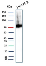 Western blot analysis of Cytotoxic Lymphocyte Perforin Antibody in HDLM-2 cell lysate. HDLM-2 lysate shows a prominent band at approximately 70 kDa, consistent with the predicted molecular weight of Perforin-1. The signal appears as a strong, specific band under reducing SDS-PAGE conditions, with minor higher molecular weight signal that may represent protein aggregation or incompletely reduced species. The observed band aligns with endogenous PRF1 expression, which is expected in activated or cytotoxic lymphoid cell populations.