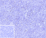 Immunohistochemistry analysis of Cytotoxic Lymphocyte Perforin Antibody in human spleen tissue. Formalin-fixed, paraffin-embedded human spleen stained with Perforin-1 Recombinant Rabbit Monoclonal Antibody (clone PRF1/9681R) demonstrates punctate cytoplasmic HRP-DAB brown staining in scattered lymphoid cells within the white pulp, consistent with perforin localization in cytotoxic T lymphocytes and natural killer cells. The majority of surrounding lymphocytes are negative, highlighting the restricted expression pattern of PRF1 in activated cytotoxic subsets. The inset image shows the negative control in which PBS was used in place of the primary antibody, confirming absence of non-specific secondary antibody staining. Heat-induced epitope retrieval was performed by boiling tissue sections in pH 9, 10mM Tris with 1mM EDTA for 45 minutes at 95oC followed by cooling prior to immunostaining.