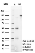 SDS-PAGE Analysis of Purified Cytotoxic Lymphocyte Perforin/PRF1 antibody (PRF1/9681R). Confirmation of Purity and Integrity of Antibody.