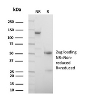 SDS-PAGE Analysis of Purified PVALB/Parvalbumin antibody (r2E11). Confirmation of Purity and Integrity of Antibody.
