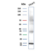 Western blot analysis of PV/Parvalbumin alpha antibody (clone rPVALB/9839) in human heart tissue lysate. A distinct immunoreactive band is observed at approximately 12 kDa, consistent with the predicted molecular weight of Parvalbumin based on its amino acid sequence. The band migrates in the expected low molecular weight range for this small cytosolic EF-hand calcium-binding protein. Faint higher molecular weight background signal may be visible above 25 kDa; however, the predominant band corresponds to the predicted molecular weight, supporting specific detection of Parvalbumin in human heart tissue.