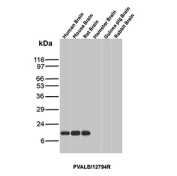 Western blot analysis of Calcium-Binding Protein PV/PVALB antibody (clone PVALB/12794R) in brain tissue lysates from multiple species. Brain lysates from human, mouse, and rat show clear immunoreactive bands at approximately 12 kDa, consistent with the predicted molecular weight of Parvalbumin based on its amino acid sequence. No specific band is observed in hamster brain, guinea pig brain, or rabbit brain under the conditions tested. The detected bands migrate in the expected low molecular weight range for this small cytosolic EF-hand calcium-binding protein, supporting species-reactive detection of Parvalbumin in human, mouse, and rat brain tissue.