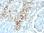 Immunohistochemistry analysis of Fast-Spiking Interneuron Marker/Parvalbumin antibody (clone PVALB/12610R) in human kidney tissue. FFPE human kidney shows cytoplasmic HRP-DAB brown staining within renal tubular epithelial cells, consistent with Parvalbumin expression. Staining is localized predominantly to the cytoplasm of tubular structures, while adjacent glomerular elements and surrounding interstitial cells demonstrate minimal specific signal. The inset image represents a secondary antibody negative control in which PBS was used in place of the primary antibody and shows absence of specific staining. Heat induced epitope retrieval was performed by heating tissue sections in 10 mM Tris with 1 mM EDTA, pH 9.0, at 95oC for 45 minutes followed by cooling at room temperature for 20 minutes prior to immunostaining.