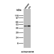 Formalin-fixed, paraffin-embedded human cervix stained with Alpha-SMA/Myofibroblast Marker antibody (clone ACTA2/13673R). Inset: PBS instead of primary antibody; secondary only negative control.