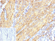 Immunohistochemistry analysis of Alpha-SMA / ACTA2 antibody (clone ACTA2/13673R) in human cervix tissue. FFPE human cervix shows strong cytoplasmic HRP-DAB brown staining in smooth muscle cells within the stromal and muscular layers, consistent with Alpha smooth muscle actin expression. Staining highlights elongated spindle-shaped smooth muscle cells arranged in bundles, while epithelial components demonstrate minimal specific signal. Nuclei are counterstained blue. The inset image represents a secondary antibody negative control in which PBS was used in place of the primary antibody and shows absence of specific staining. Heat induced epitope retrieval was performed by heating tissue sections in 10 mM Tris with 1 mM EDTA, pH 9.0, at 95oC for 45 minutes followed by cooling at room temperature for 20 minutes prior to immunostaining.