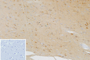 Immunohistochemistry analysis of Burkitt Lymphoma Receptor 1 antibody in human brain tissue. FFPE human brain sections show light HRP-DAB brown staining in scattered perivascular and parenchymal cells, consistent with CXCR5, also known as CD185, expression in resident or infiltrating immune-associated cells. Neuronal and glial populations demonstrate minimal background staining. The inset negative control, in which PBS was used in place of primary antibody, shows no specific brown chromogenic signal. Heat induced epitope retrieval was performed in 10 mM Tris with 1 mM EDTA, pH 9.0, by heating at 95oC for 45 minutes followed by cooling at room temperature for 20 minutes.