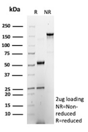 SDS-PAGE Analysis of Purified Burkitt Lymphoma Receptor 1/CXCR5 antibody (CXCR5/13100). Confirmation of Purity and Integrity of Antibody.