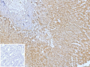 Immunohistochemistry analysis of C-X-C Motif Chemokine Receptor 5 antibody in human adrenal gland tissue. FFPE human adrenal sections show strong HRP-DAB brown membranous and cytoplasmic staining in scattered immune-associated cells within the adrenal medulla, consistent with CXCR5, also known as CD185, expression in lymphoid cells. Adrenocortical cells demonstrate minimal staining. The inset negative control, in which PBS was used in place of primary antibody, shows no specific brown chromogenic signal. Heat induced epitope retrieval was performed in 10 mM Tris with 1 mM EDTA, pH 9.0, by heating at 95oC for 45 minutes followed by cooling at room temperature for 20 minutes.