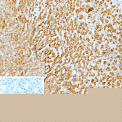 Immunohistochemistry analysis of BLR1 antibody in human adrenal gland tissue. FFPE human adrenal sections show strong HRP-DAB brown membranous and cytoplasmic staining in numerous immune-associated cells within the adrenal medulla, consistent with CXCR5, also known as CD185, expression in lymphoid cells. Adrenocortical cells demonstrate minimal background staining. The inset negative control, in which PBS was used in place of primary antibody, shows no specific brown chromogenic signal. Heat induced epitope retrieval was performed in 10 mM Tris with 1 mM EDTA, pH 9.0, by heating at 95oC for 45 minutes followed by cooling at room temperature for 20 minutes.