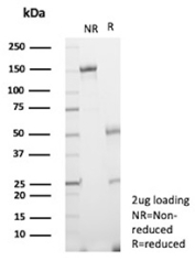 SDS-PAGE Analysis of Purified BLR1/CXCR5 antibody (clone CXCR5/13096). Confirmation of Purity and Integrity of Antibody.