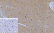 Immunohistochemistry analysis of CD185 Chemokine Receptor antibody in human adrenal gland tissue. FFPE human adrenal sections show light HRP-DAB brown membranous and cytoplasmic staining in scattered immune-associated cells within the adrenal medulla, consistent with CXCR5 expression in lymphoid cells. Adrenocortical cells demonstrate minimal background staining. The inset negative control, in which PBS was used in place of primary antibody, shows no specific brown chromogenic signal. Heat induced epitope retrieval was performed in 10 mM Tris with 1 mM EDTA, pH 9.0, by heating at 95oC for 45 minutes followed by cooling at room temperature for 20 minutes.