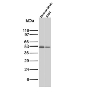 Western blot analysis of SOX10 antibody (clone rSOX10/13506). Human brain tissue lysate and A431 whole cell lysate were resolved by SDS-PAGE and immunoblotted with SRY-box transcription factor 10 antibody. A specific band is detected at approximately 53 kDa, consistent with the predicted molecular weight of SOX10.