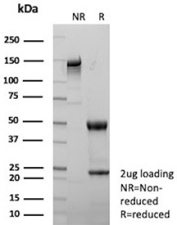 Signal Transducer 6 Antibody SDS-PAGE (Reducing vs Non-Reducing). SDS-PAGE analysis of Signal Transducer 6 antibody clone STAT6/12798R under reducing (R) and non-reducing (NR) conditions, demonstrating expected antibody heavy and light chain band patterns.
