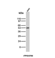 Cellular Tumor Antigen p53 Antibody / TP53 antibody (clone rTP53/3780). Western blot analysis of human A431 cell lysate shows a band at approximately 53 kDa, consistent with the predicted molecular weight of Tumor protein p53 / TP53. This result demonstrates detection of endogenous p53 protein in A431 cells by western blot.