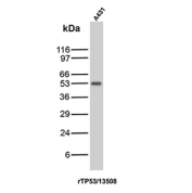 Western blot analysis of Tumor Suppressor p53 / TP53 antibody in human A431 cell lysate (clone rTP53/13508). A distinct band is observed at approximately 53 kDa, consistent with the predicted molecular weight of Tumor protein 53. The detected band corresponds to endogenous p53 expressed in A431 cells. The migration pattern aligns with the expected size of full length TP53 under reducing SDS-PAGE conditions.