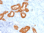 Immunohistochemistry analysis of D28K / CALB1 antibody (clone rCALB1/9805) in human kidney tissue. Formalin-fixed, paraffin-embedded human kidney demonstrates strong cytoplasmic HRP-DAB brown staining in subsets of renal tubular epithelial cells, consistent with Calbindin expression, while adjacent interstitial and glomerular regions are largely negative. The inset shows PBS used in place of primary antibody as a negative control, confirming absence of specific staining. Heat-induced epitope retrieval was performed by heating tissue sections in 10 mM Tris with 1 mM EDTA, pH 9.0, for 45 minutes at 95oC followed by cooling at room temperature for 20 minutes prior to staining.