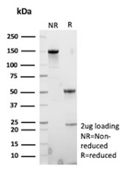 SDS-PAGE Analysis of Purified Placental Protein 5/TFPI2 antibody (TFPI2/13028). Confirmation of Purity and Integrity of Antibody.