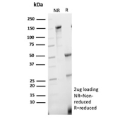 SDS-PAGE Analysis of Purified NANOG Transcription Factor/Nanog antibody (NANOG/9704). Confirmation of Purity and Integrity of Antibody.