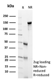 SDS-PAGE Analysis of Purified CCNE1/Cyclin E1 antibody (r13A3). Confirmation of Purity and Integrity of Antibody.